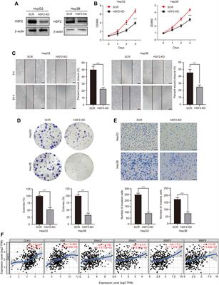 Integrated Bioinformatics Analysis Identifies Heat Shock Factor 2 as a Prognostic Biomarker Associated With Immune Cell Infiltration in Hepatocellular Carcinoma